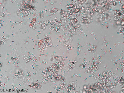 phyto/Pertuis Charentais/Tasdon_st2/PAMPAS 2019-2021/Monoraphidium sp1 (old Ankistrodesmus sp3 -TASDON_St2_140319-004).tif(copy)_thumb.jpg